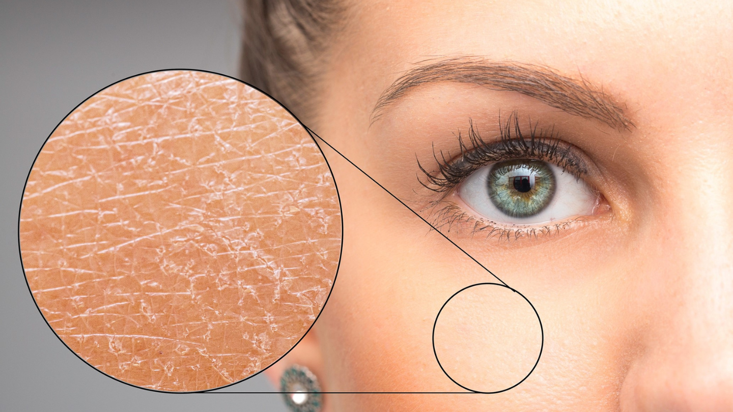 Dry Skin Care Recommendations